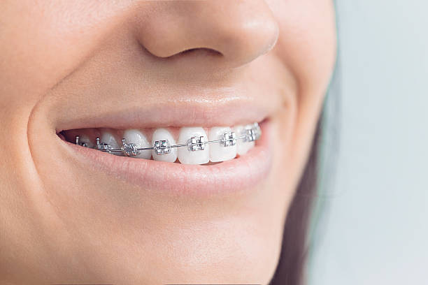Best Wisdom Tooth Removal  in Salamatof, AK